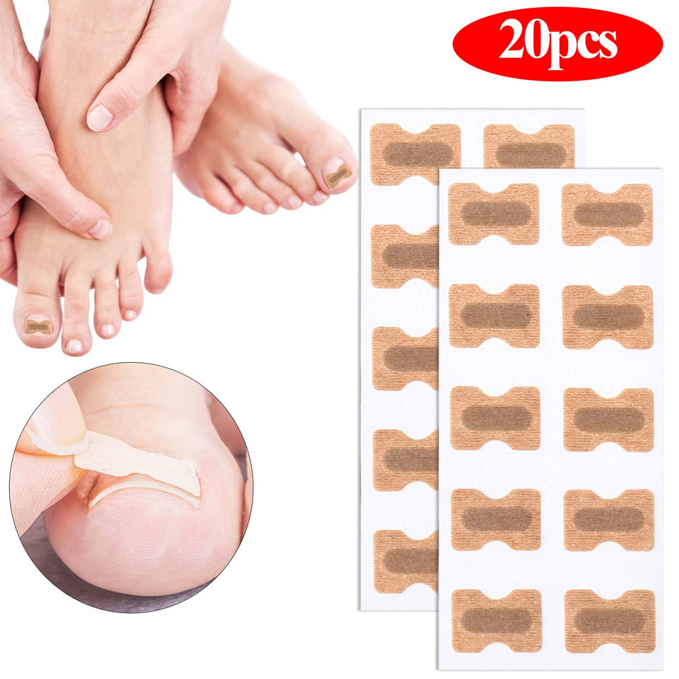 Ingrown Toenail Corrector Patches