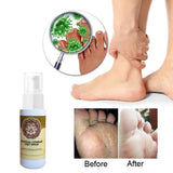 Anti-Fungal Treatment Spray